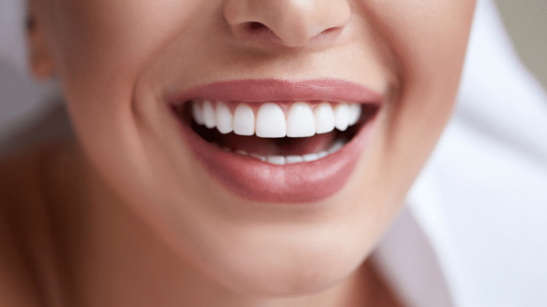 Des dents blanches